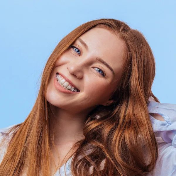 A woman smiling with Smile White ceramic braces, manufacturer's photo